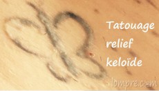 tatouage-relief-keloide